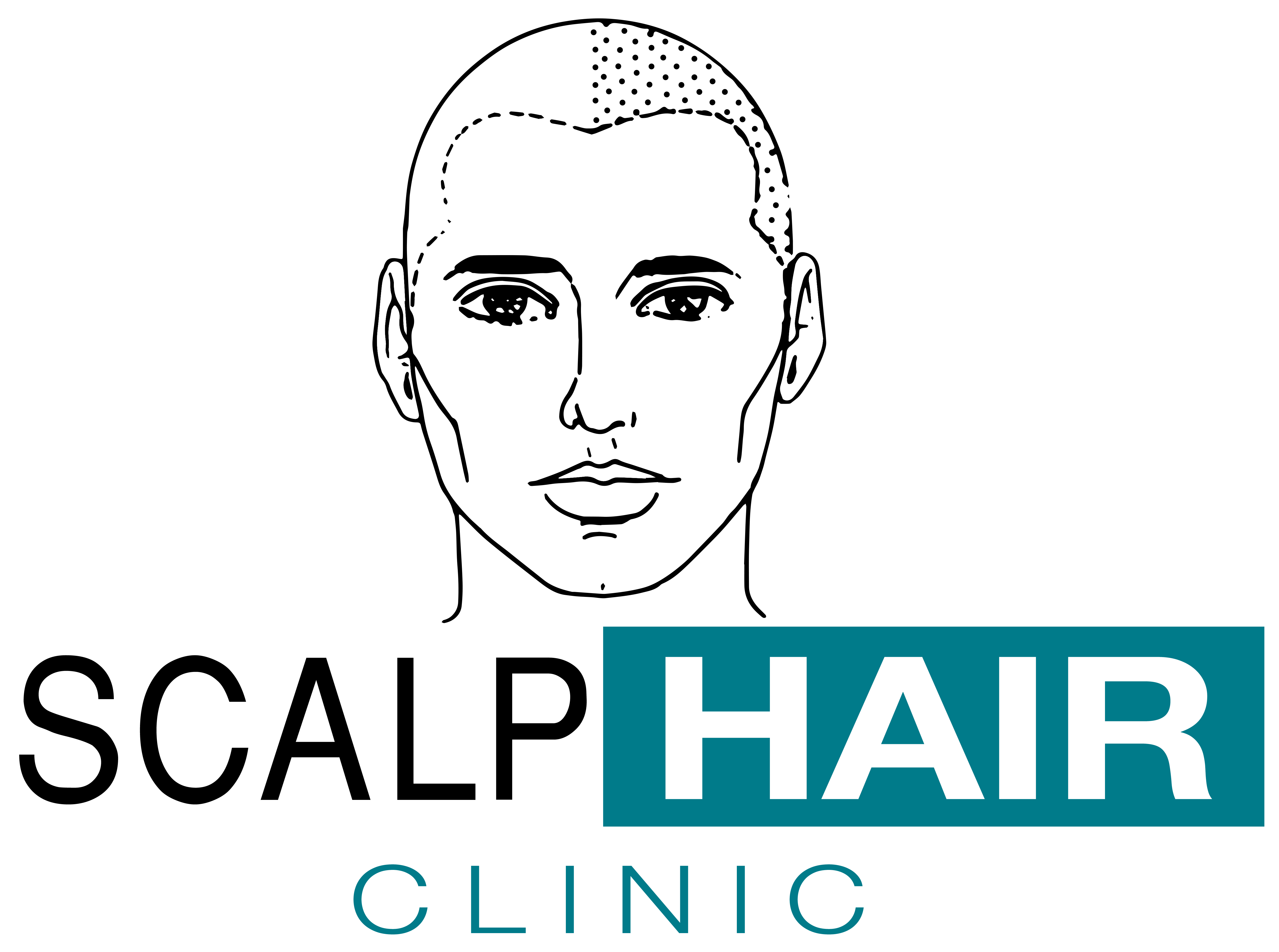 logo_scalp_hair