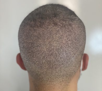Julian après face