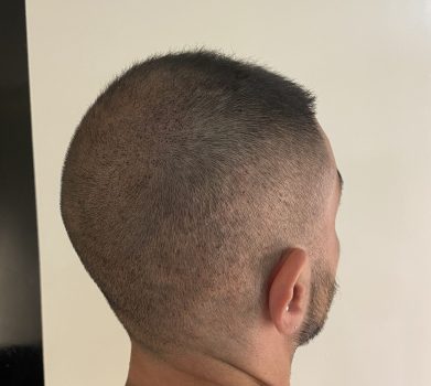 Kevin Gauche après